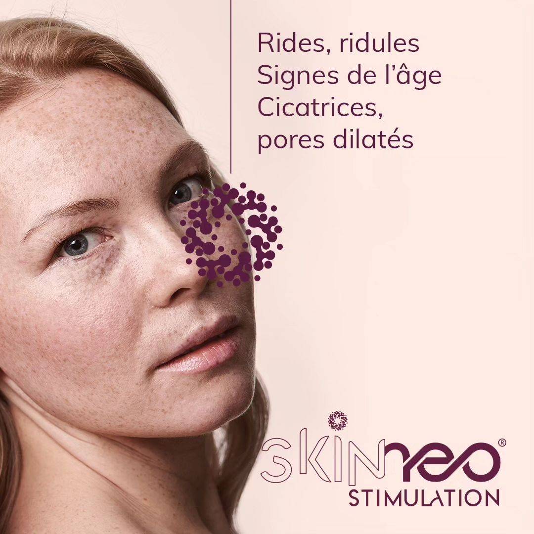 SkinNéo Stimulation, dispositif esthétique pour la stimulation douce de l'épiderme, sans douleur ni effets secondaires, avec résultats visibles et durables.